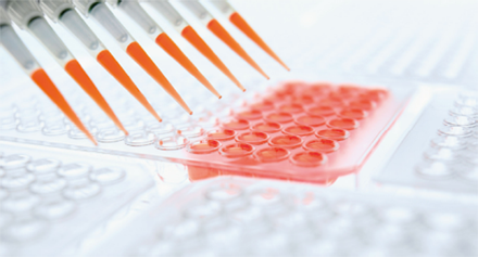 IVD价值压力持续增大 经济型试剂更受医院青睐